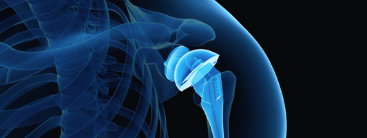 Shoulder Arthroplasty and Infection: Why Nutrition Matters