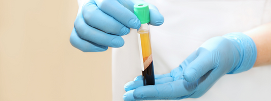 How to Get the Most Out of Your PRP Treatment: Optimizing Your Biology in the Era of Regenerative Medicine