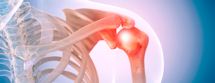arthroscopic rotator cuff repair